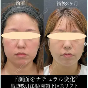 湘南美容クリニック 名古屋駅本院 豊嶋 沙良医師の症例