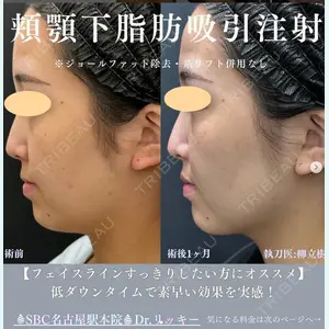 湘南美容クリニック 豊橋院 柳 立樹医師の症例