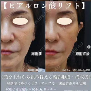 湘南美容クリニック 豊橋院 柳 立樹医師の症例
