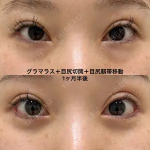 エターナル美容クリニック 久門田 詳医師の症例