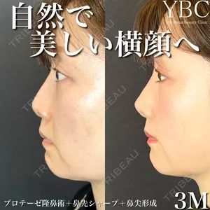 YBC横浜美容外科 大宮院 磯村 亮輔医師の症例