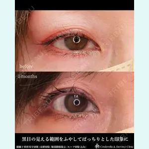 シンデレラ＆ダヴィンチクリニック 宮田 洋佑医師の症例