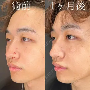 症例