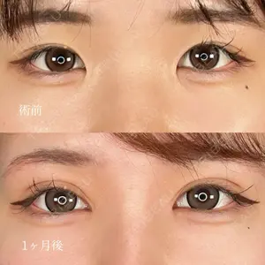 症例