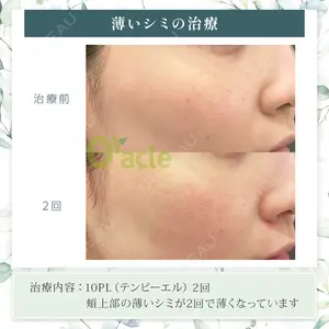 オラクル美容皮膚科 東京新宿院の症例
