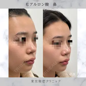 症例