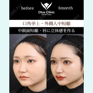 Otus Clinic 【オータスクリニック】 中 徳太郎医師の症例