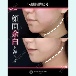 東京形成美容外科 船橋院 弓削田　浩主医師の症例