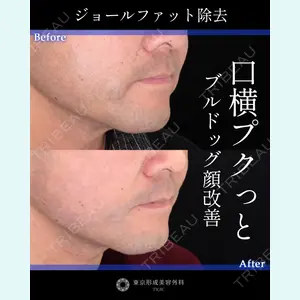 東京形成美容外科 船橋院 山崎 修吾医師の症例