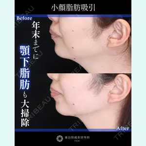 東京形成美容外科 船橋院 山崎 修吾医師の症例