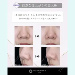 東京形成美容外科 銀座院 中尾 真紀医師の症例