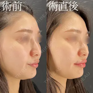 HAAB×DREAM BEAUTY CLINIC 大阪梅田院 柏木 太雅医師の症例
