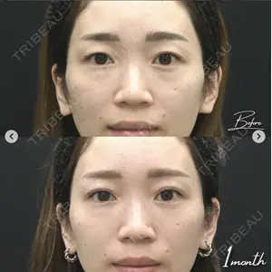 湘南美容クリニック 金山院の症例