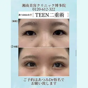 症例