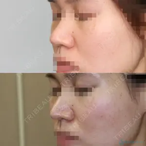 聖心美容クリニック 名古屋院 加藤 大典医師の症例