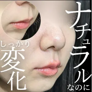 ルラ美容クリニック 高田馬場院 若佐 卓矢医師の症例