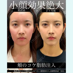 症例