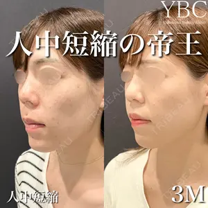 YBC横浜美容外科 大宮院 磯村 亮輔医師の症例