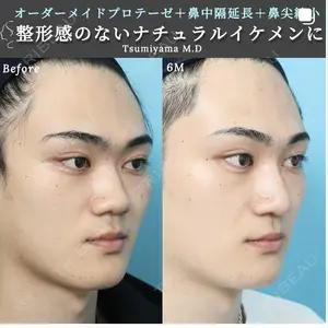 症例