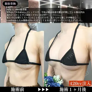 症例