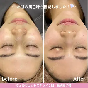 ジュエルクリニック 恵比寿院の症例