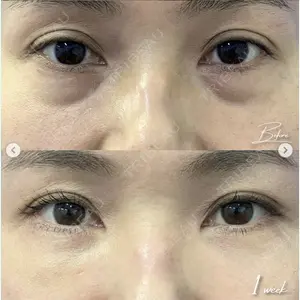 湘南美容クリニック 銀座院の症例