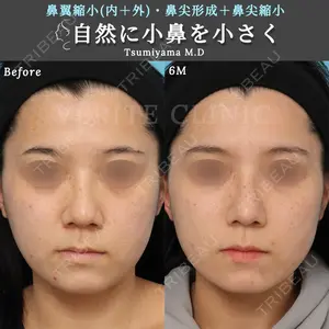 症例