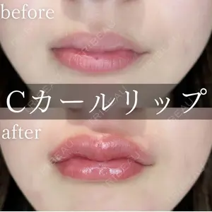 症例