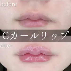 症例