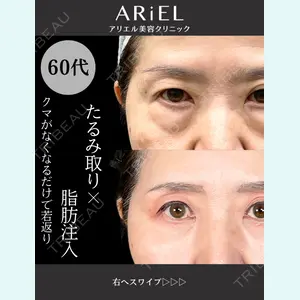 アリエル美容クリニック 大宮院 鈴木　桂介医師の症例