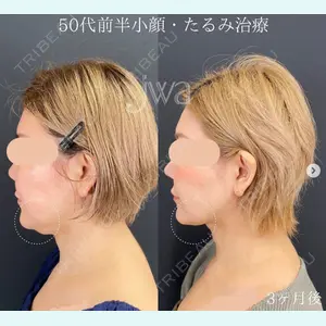 自由が丘ウェルエイジングビューティークリニック 福田 知佐子医師の症例