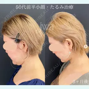 自由が丘ウェルエイジングビューティークリニック 福田 知佐子医師の症例