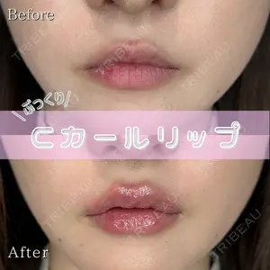 症例