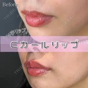 症例