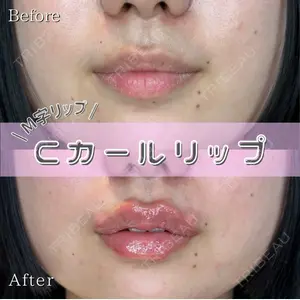 症例