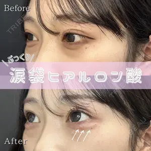 症例