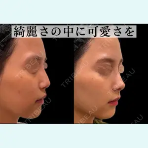 症例