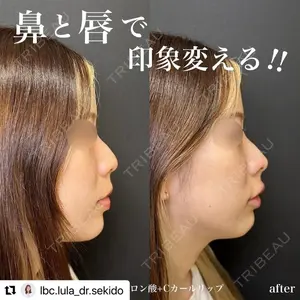 ルラ美容クリニック 名古屋栄院 関戸 優医師の症例