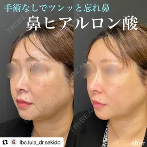 ルラ美容クリニック 名古屋栄院 関戸 優医師の症例
