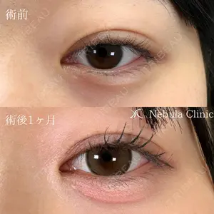 小倉美容外科ネビュラクリニックの症例