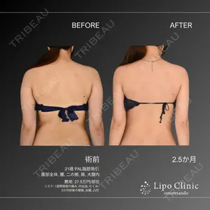 Lipo Clinic omotesando 福田 越医師の症例