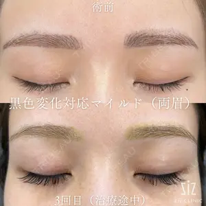 ziz CLINIC 村岡 史子医師の症例