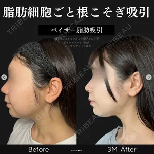症例