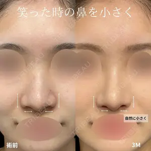 グローバルビューティークリニック 大阪院 大阪院院長 羽根和秀医師の症例