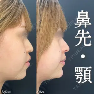 ルラ美容クリニック 大宮院 右京 大季医師の症例