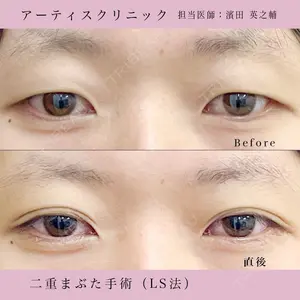 症例