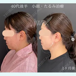 自由が丘ウェルエイジングビューティークリニック 福田 知佐子医師の症例