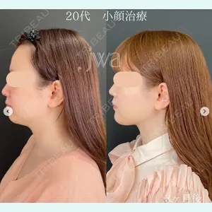 自由が丘ウェルエイジングビューティークリニック 福田 知佐子医師の症例