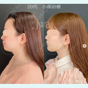自由が丘ウェルエイジングビューティークリニック 福田 知佐子医師の症例