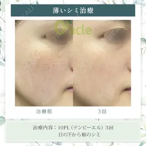 オラクル美容皮膚科 東京新宿院の症例